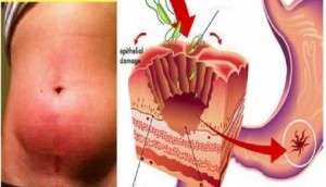 auto_kancer1511197032-750x430-300x172.jpg