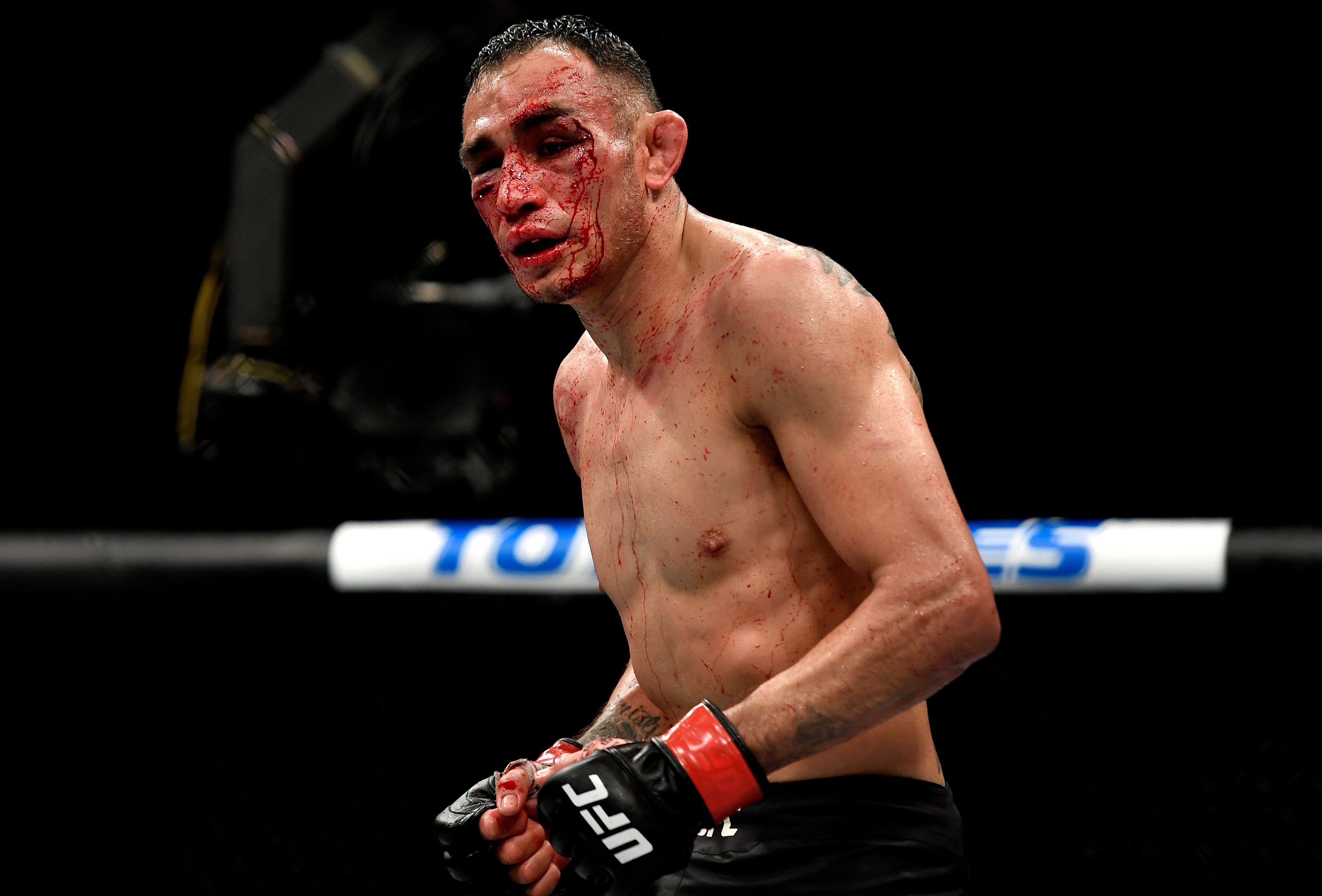 Tony Ferguson dërgohet në spital, pas disfatës ndaj Justin ...