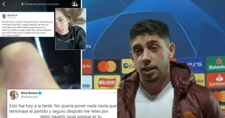 E dashura e Valverdes publikon pamje nga lëndimi i lojtarit, ai luajti me dhimbje