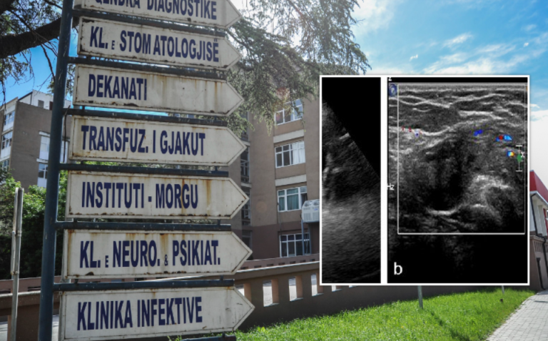 E rrallë: 67-vjeçari kosovar që ka organe gjenitale mashkullore dhe femërore