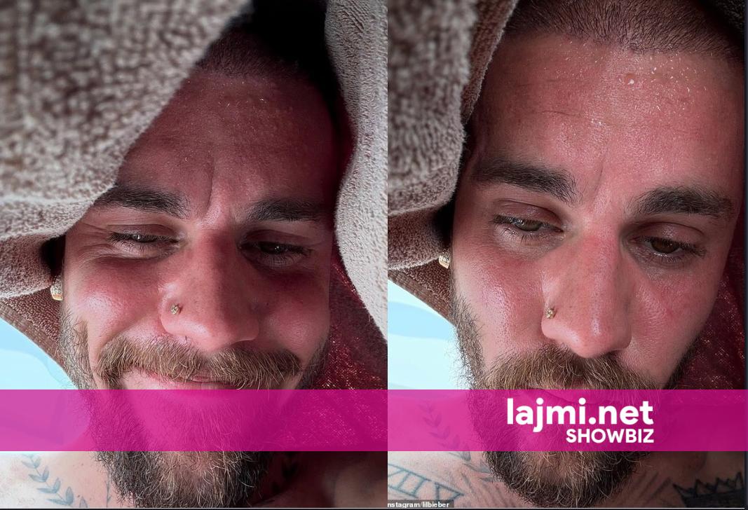 Justin Bieber ngjall shqetësim me një postim “detoksifikimi” pas fotografive me marihuanë