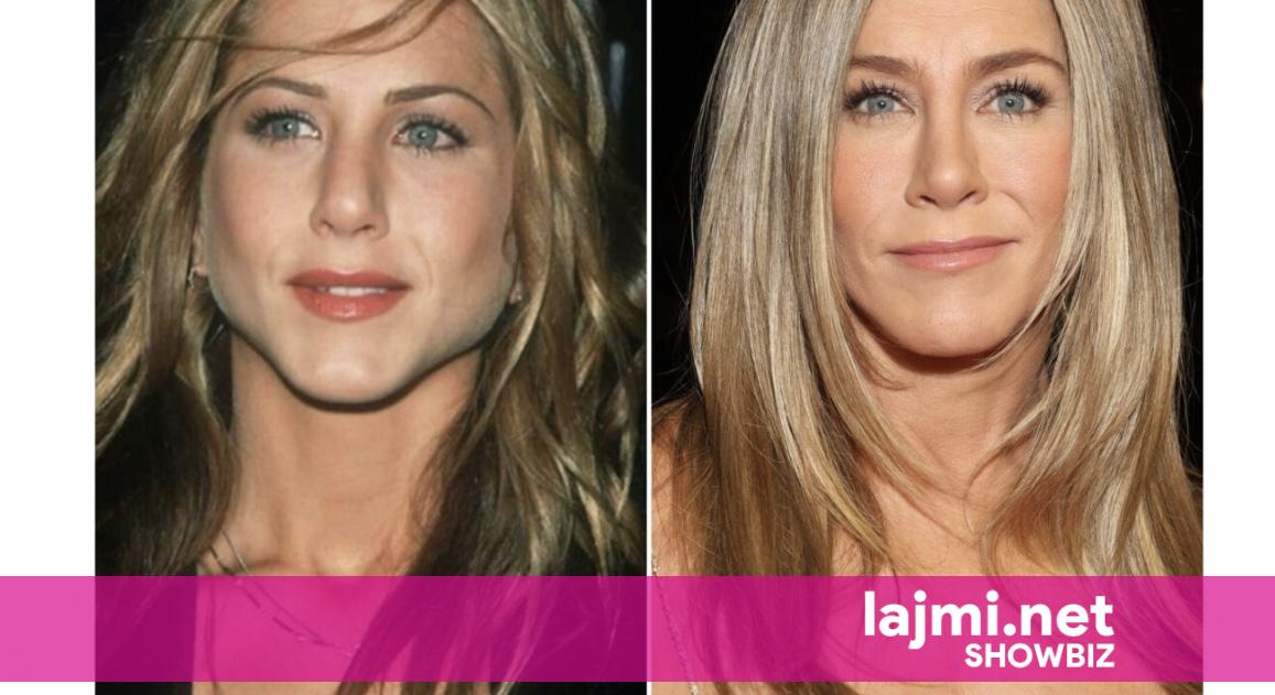 56 apo 36? Jennifer Aniston zbulon sekretet e pamjes rinore