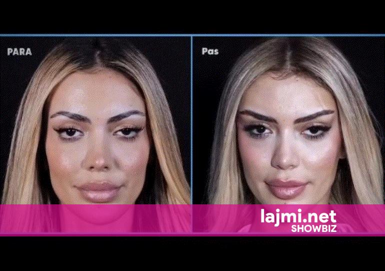 Publikohen pamjet e ndërhyrjeve të Brikenës para BBVA  reagime të shumta në rrjet