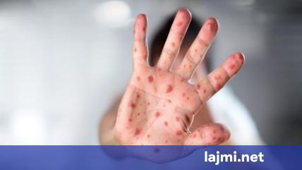 IKShPK  63 raste me fruth në Kosovë  infektimet sipas komunave
