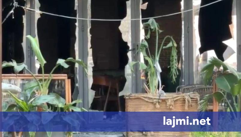 25 vjeçarja që pësoi 85  djegie të trupit dërgohet për trajtim në Turqi
