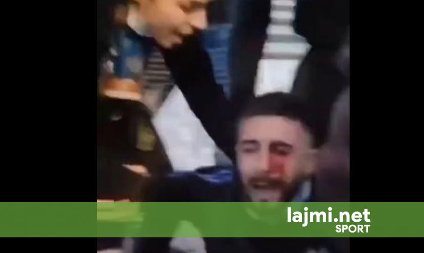 I lënduari në sy gjatë protestës në Tiranë  drejtues i  Tifozave Kuq e Zi 